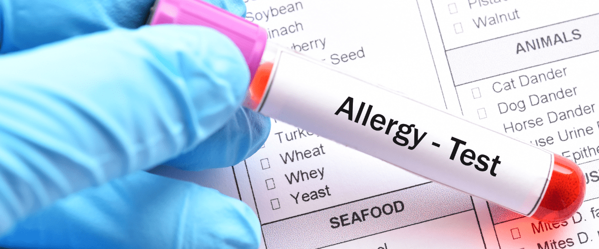 Allergy Blood Test